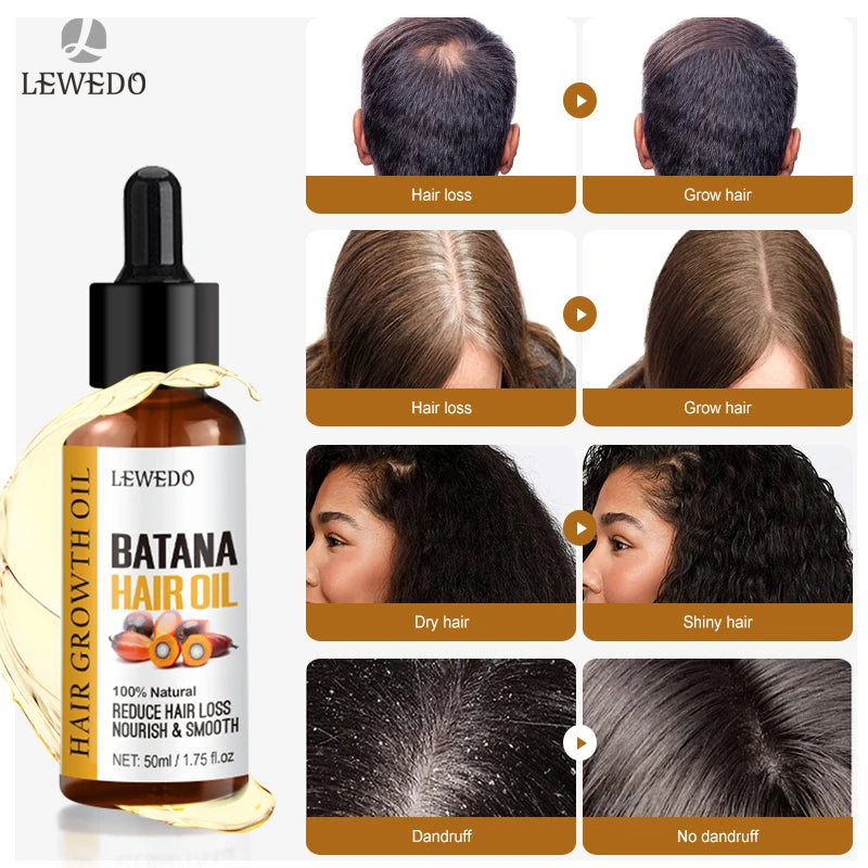 Batana Hair Growth Oil – Natural Anti Hair Loss & Repair Serum