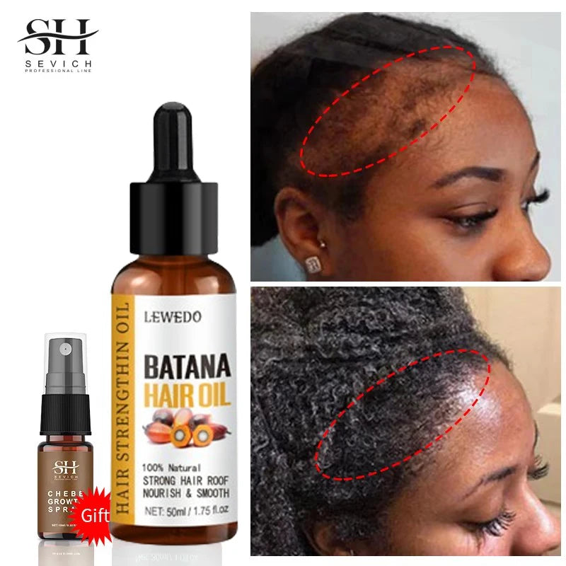Batana Hair Growth Oil – Natural Anti Hair Loss & Repair Serum